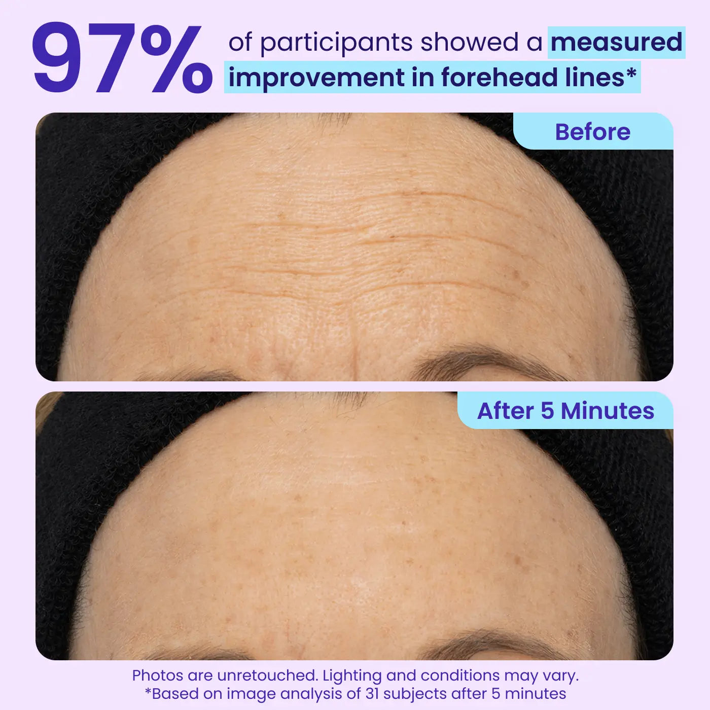 Últimas 3 horas: 60% DE DESCUENTO🔥 Gel para ojos de efecto lifting instantáneo para hinchazón, bolsas y ojeras-HS