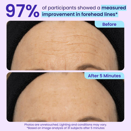 Últimas 3 horas: 60% DE DESCUENTO🔥 Gel para ojos de efecto lifting instantáneo para hinchazón, bolsas y ojeras-HS