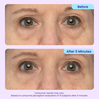 Últimas 3 horas: 60% DE DESCUENTO🔥 Gel para ojos de efecto lifting instantáneo para hinchazón, bolsas y ojeras-HS