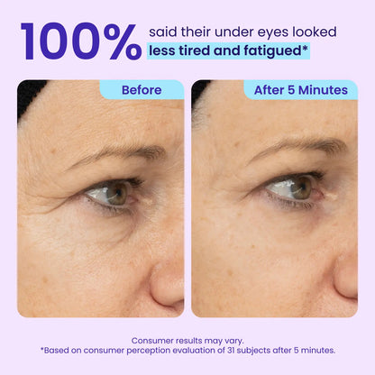 Últimas 3 horas: 60% DE DESCUENTO🔥 Gel para ojos de efecto lifting instantáneo para hinchazón, bolsas y ojeras-HS