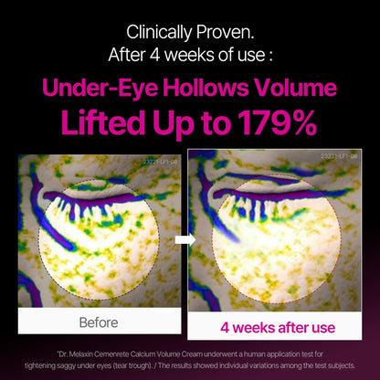 Crema coreana para ojos con calcio y antimanchas oscuras - HS
