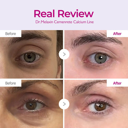 Crema coreana para ojos con calcio y antimanchas oscuras - HS
